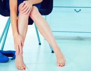 Varices